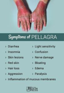 the-best-ways-to-prevent-pellagra-the-lack-of-micronutrients